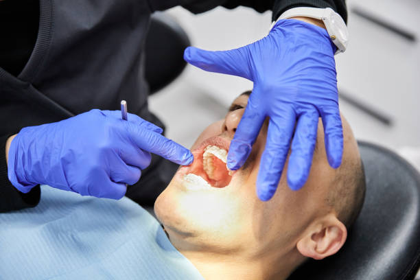 Best Broken Tooth Emergency  in Ocean City, NJ